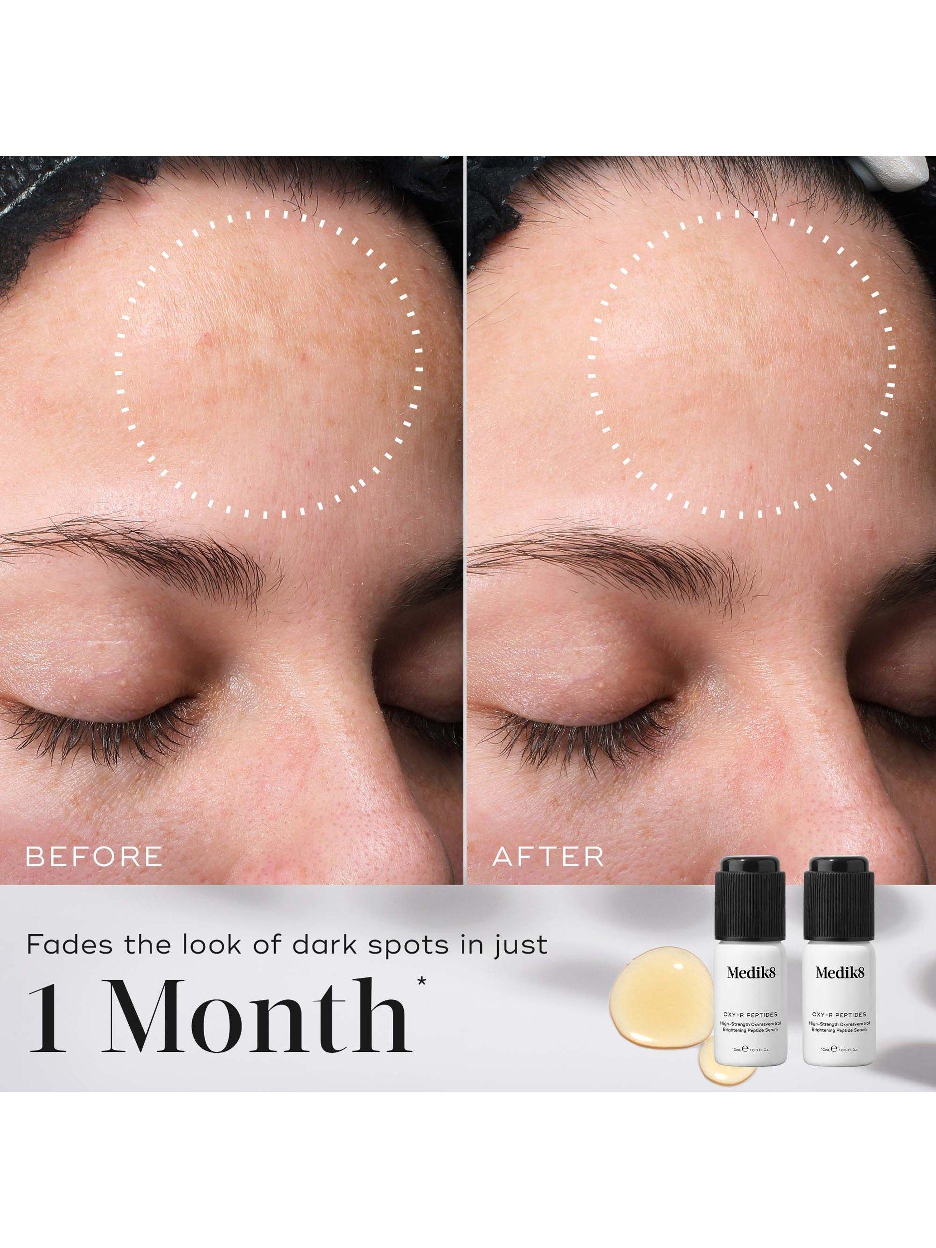 Product image 3 of 6, which shows Medik8 Oxy-R Peptides High-Strength Oxyresveratrol Brightening Peptide Serum, 2 x 10ml