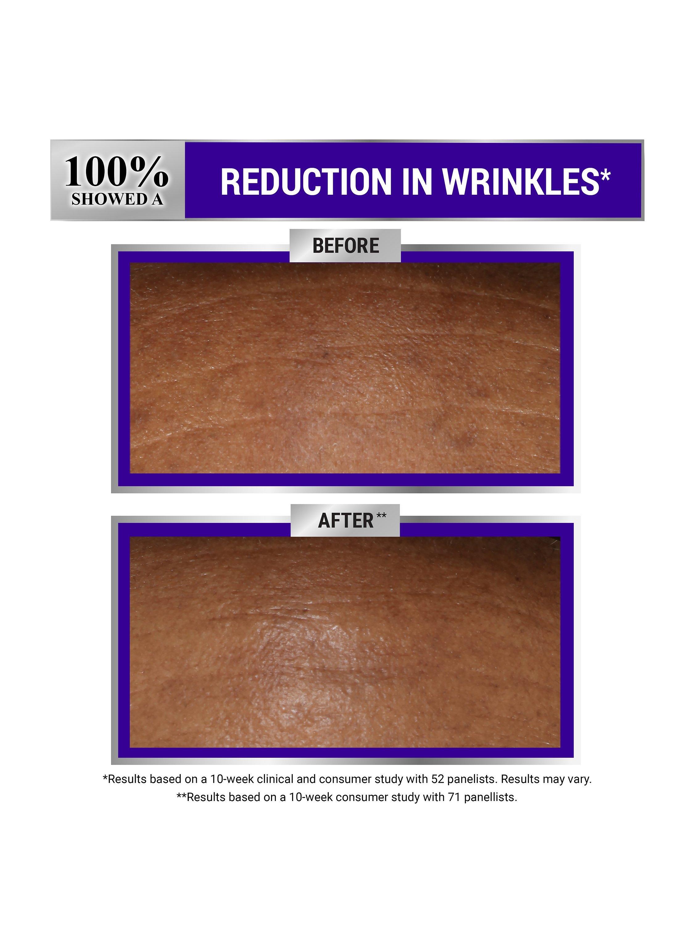 Product image 6 of 7, which shows Kiehl's Retinol Fast Release Wrinkle-Reducing Night Serum, 28ml