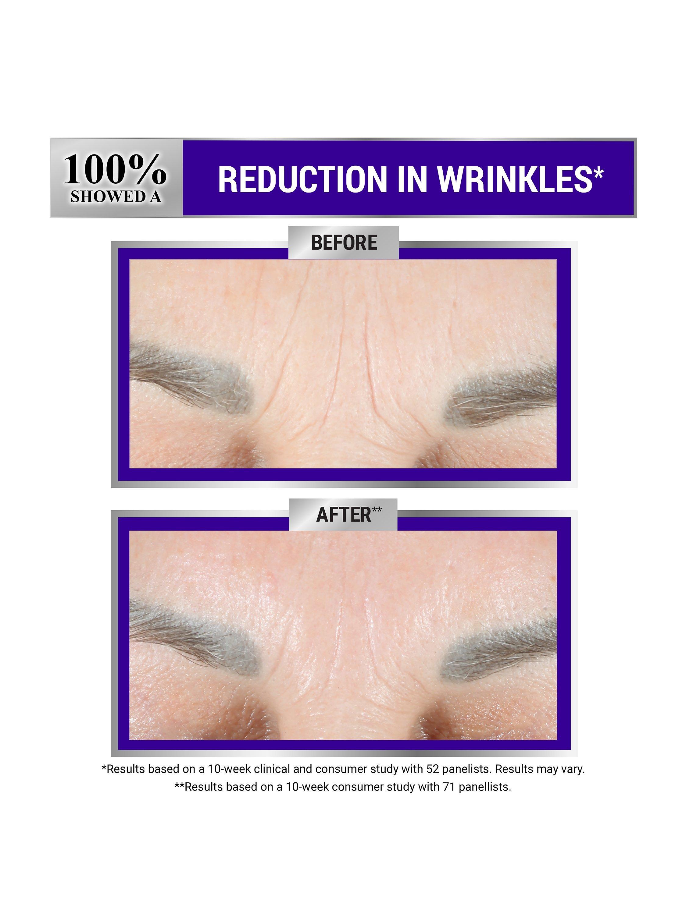 Product image 7 of 7, which shows Kiehl's Retinol Fast Release Wrinkle-Reducing Night Serum, 28ml