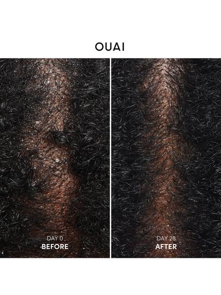 OUAI Anti -Dandruff Shampoo, 300ml - view 2, 
