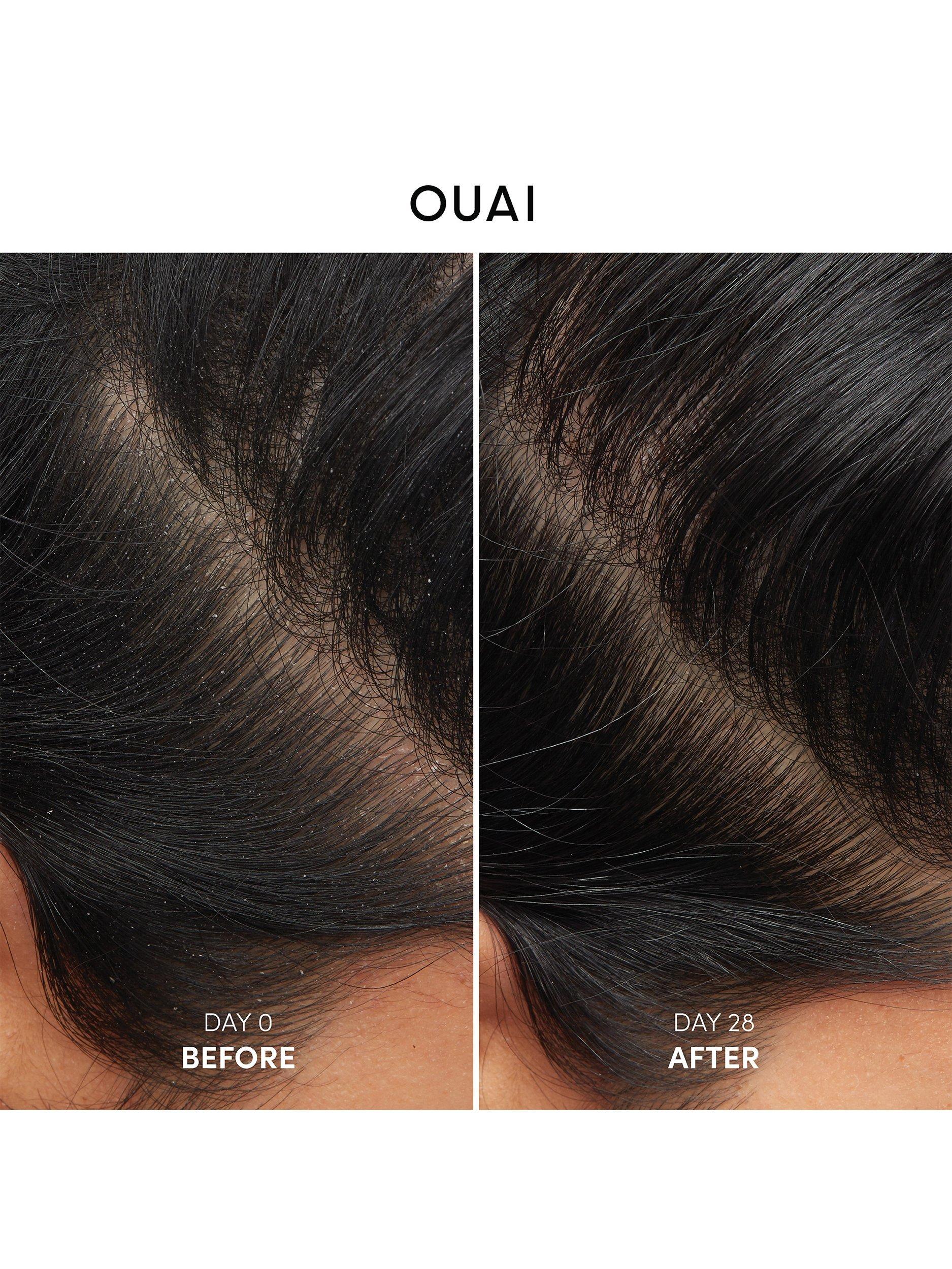 Product image 10 of 10, which shows OUAI Anti -Dandruff Shampoo, 300ml