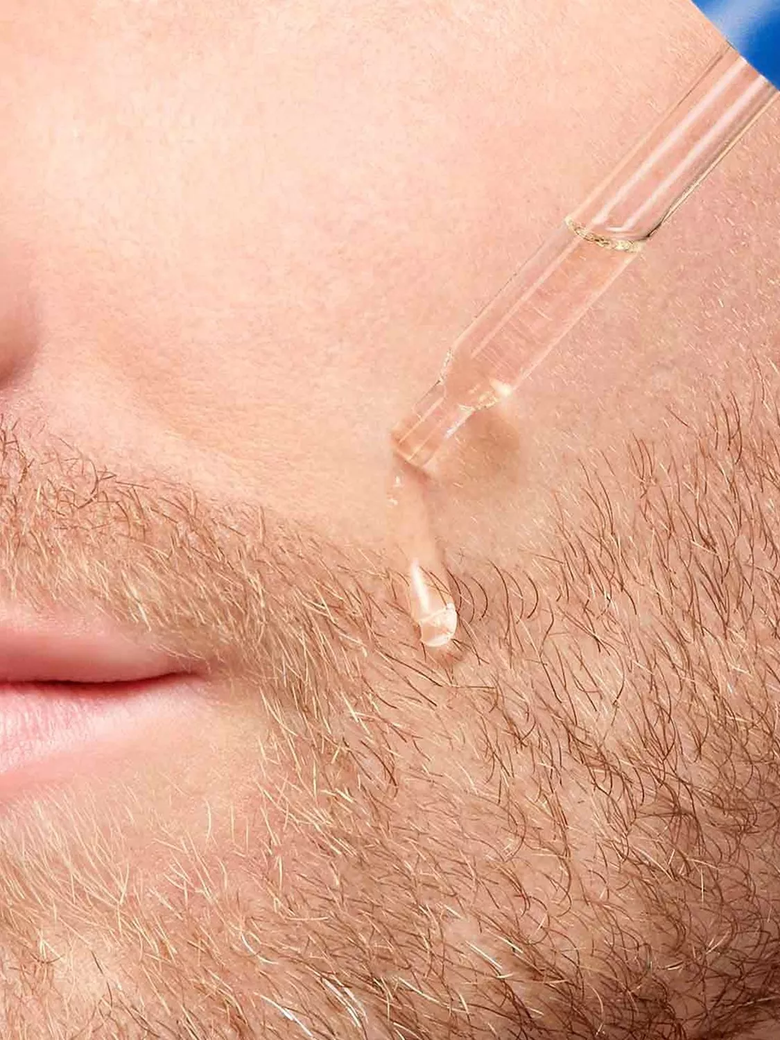 Close-up of man applying hyaluronic acid serum with dropper to cheek for hydrating skincare routine.