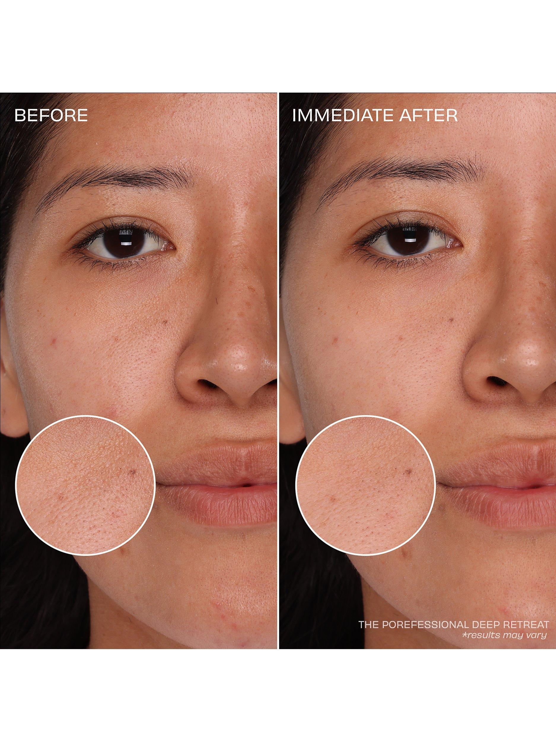 Product image 10 of 11, which shows Benefit The POREfessional Deep Retreat Pore-Clearing Clay Mask, 75ml