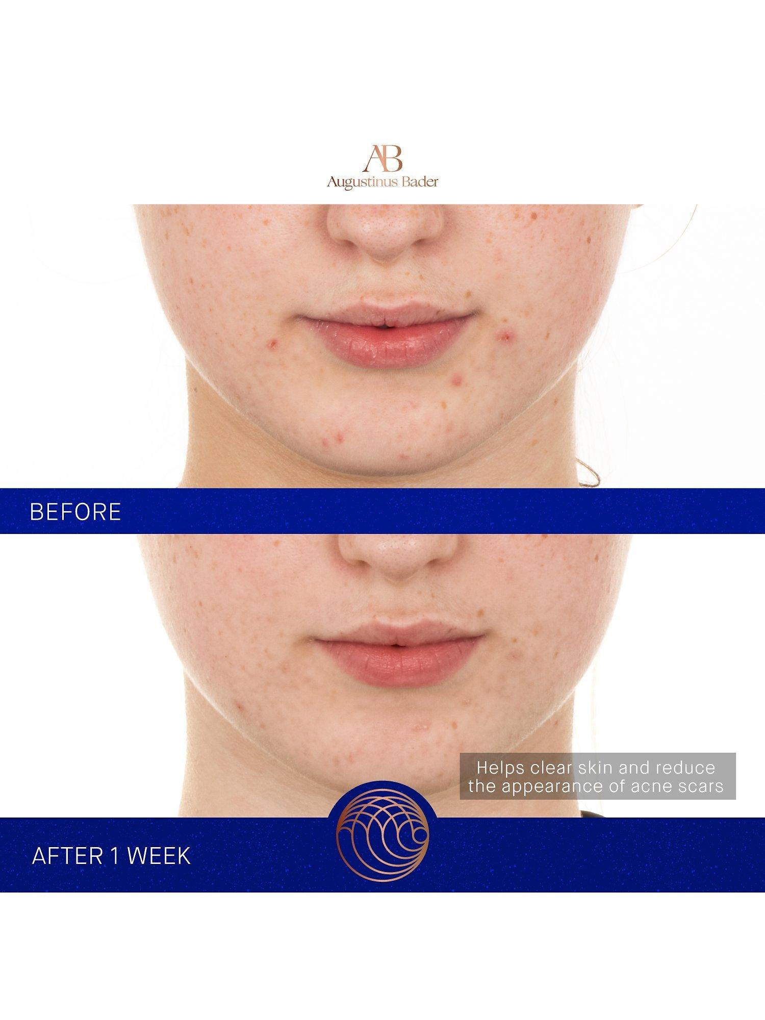 Product image 8 of 12, which shows Augustinus Bader The Retinol Serum, 30ml