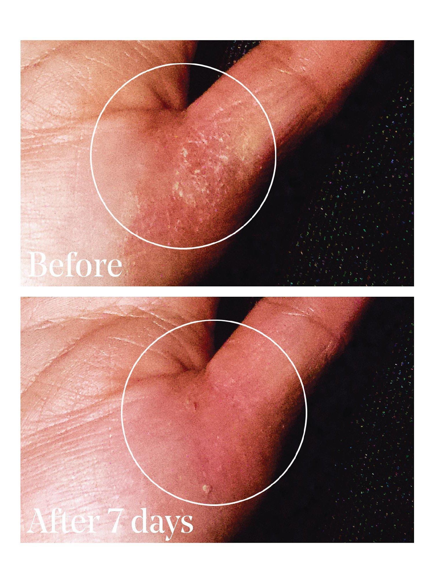 Product image 3 of 5, which shows Murad Quick Relief Moisture Treatment, 30ml