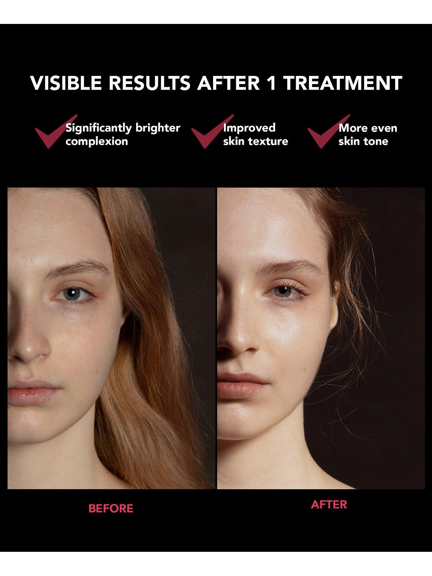 Product image 5 of 8, which shows FOREO FAQ™ 201 LED Anti-Ageing Face Mask Treatment