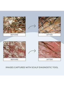 Briogeo Scalp Revival™ Charcoal + Tea Tree Scalp Treatment Drops, 30ml - view 2, 