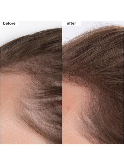 Briogeo Destined for Density™ Caffeine + Biotin  MegaStrength+ Peptide Density Serum, 45ml - view 2, 