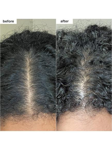 Briogeo Scalp Revival™ Charcoal + Coconut Oil Micro-Exfoliating Shampoo, 236ml - view 2, 