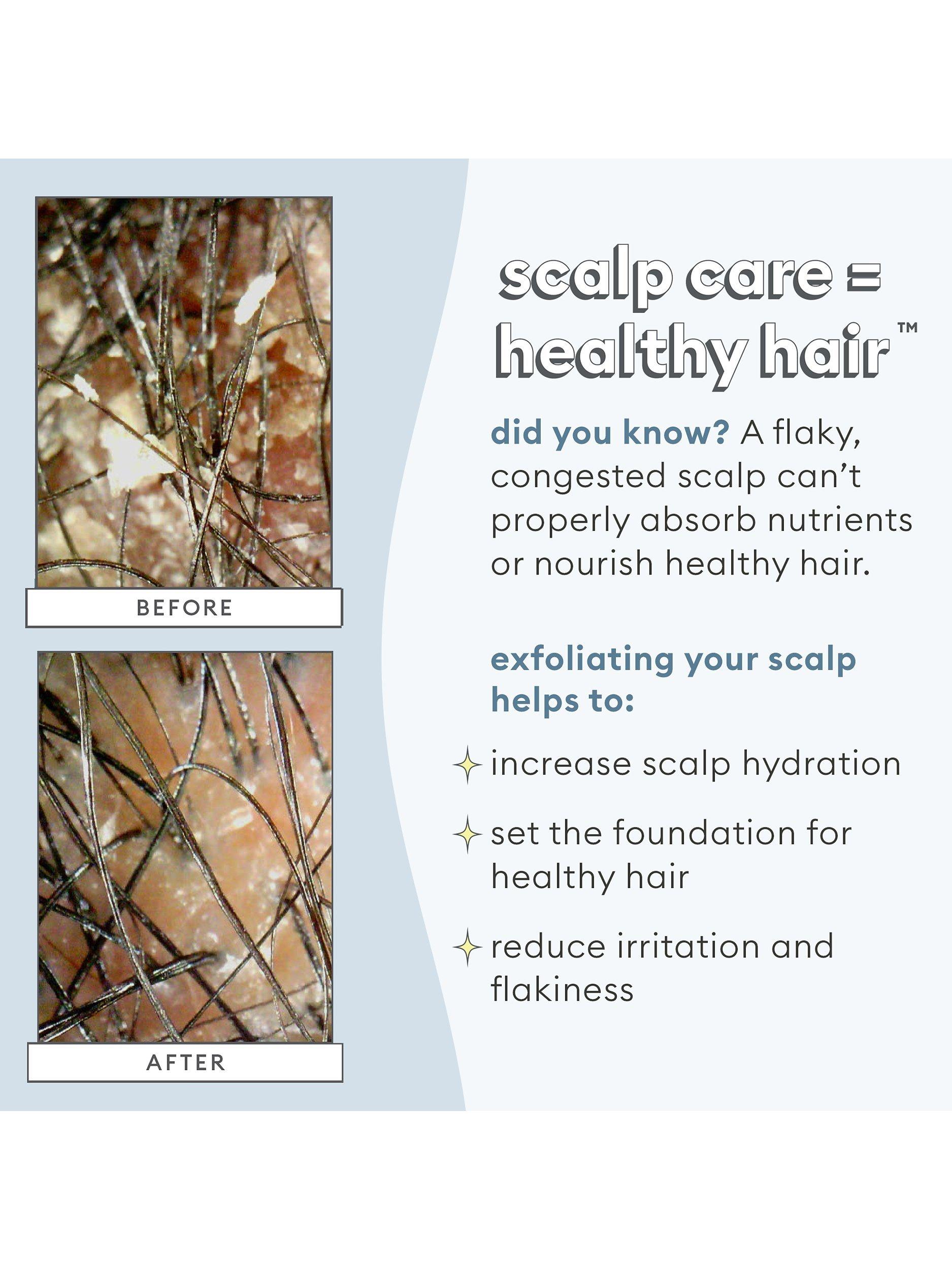 Product image 6 of 11, which shows Briogeo Scalp Revival™ Charcoal + Coconut Oil Micro-Exfoliating Shampoo, 236ml