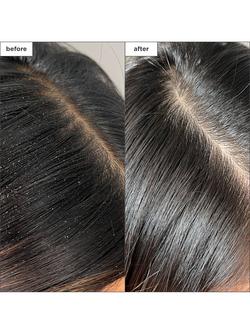 Briogeo Scalp Revival™ Charcoal + Tea Tree Buildup Detox Spray, 120ml - view 2, 