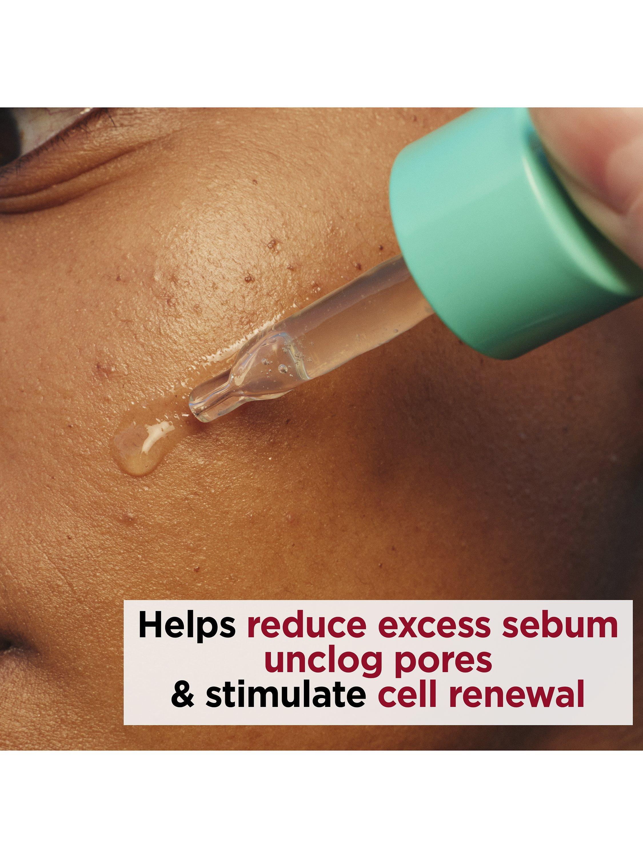 Product image 3 of 5, which shows Clarins My Clarins PURE-RESET Resurfacing Blemish Serum, 30ml