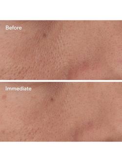 Murad Targeted Pore Corrector, 15ml - view 2, 