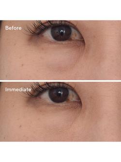 Murad Targeted Eye Depuffer, 15ml - view 2, 