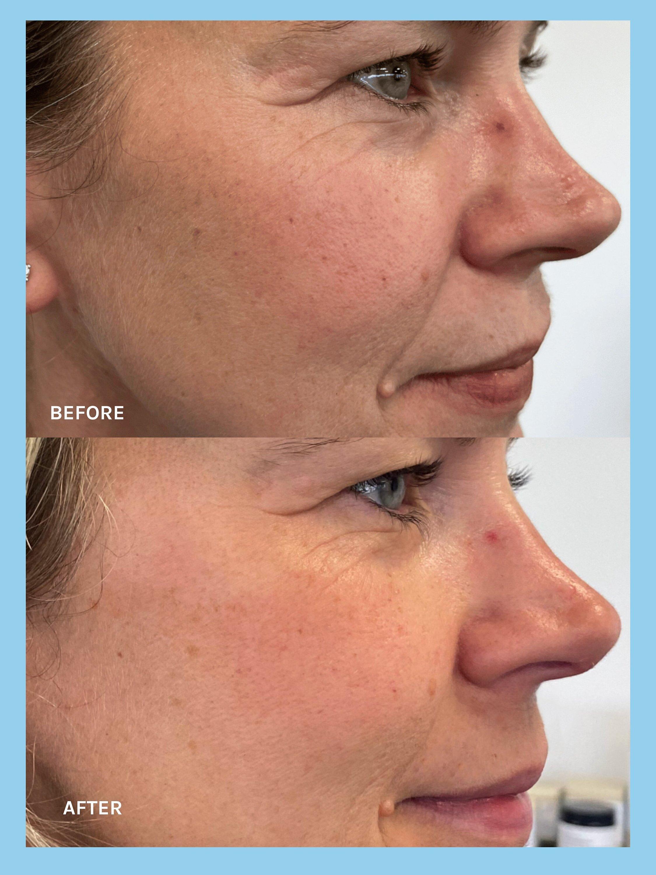 Product image 6 of 8, which shows Evolve Organic Beauty Age Defying Lifting Serum, 30ml