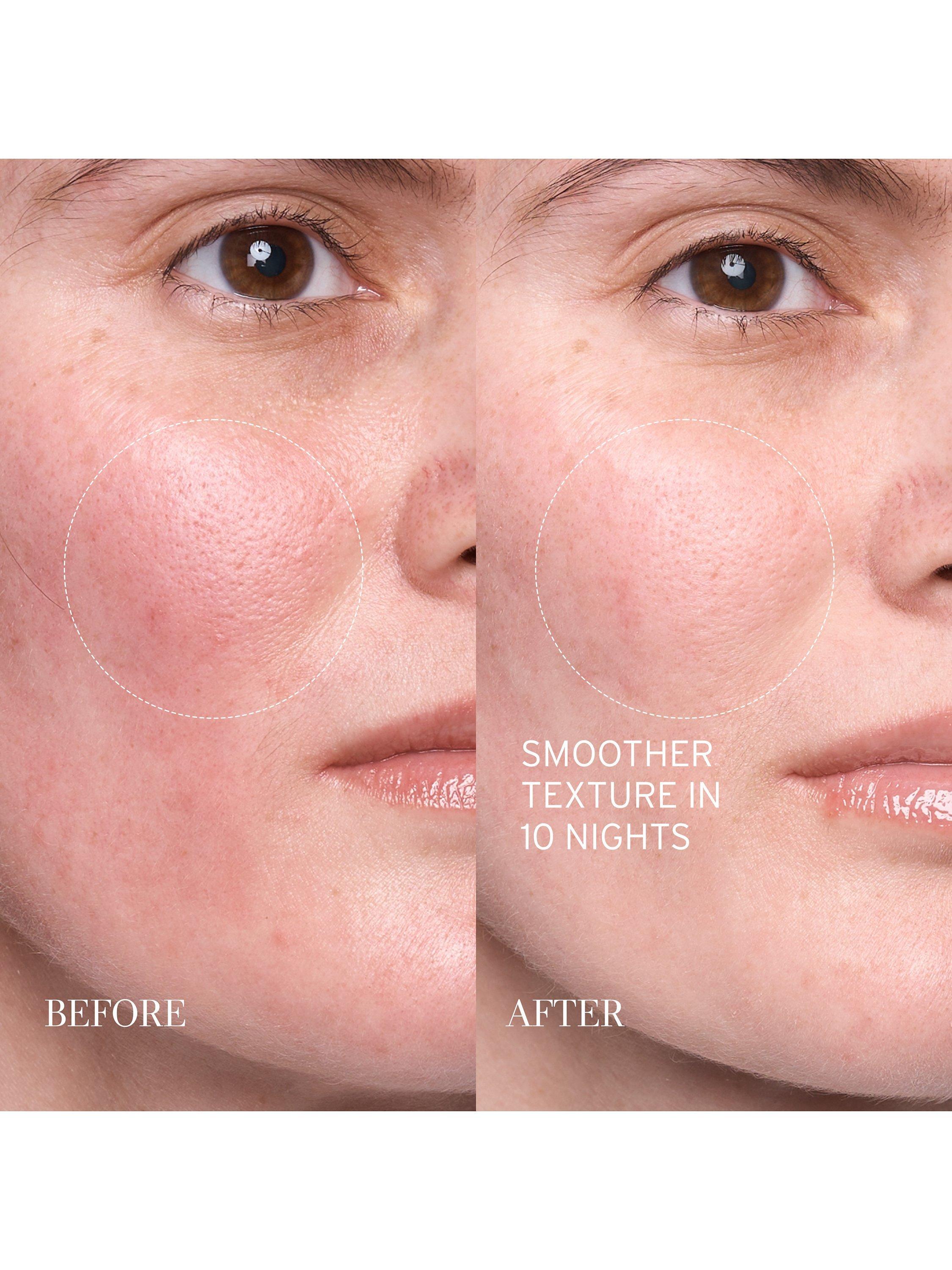 Product image 5 of 10, which shows Fresh Lotus Youth Preserve Resurfacing Dream Serum, 30ml