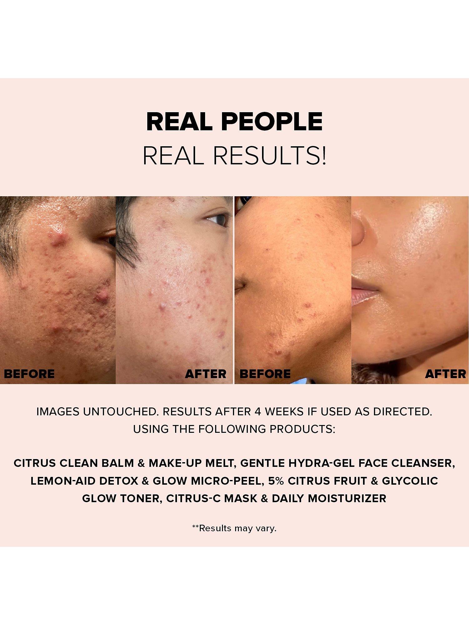 Product image 9 of 9, which shows Nudestix Nudeskin Gentle Hydra-Gel Face Cleanser, 70ml