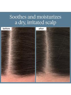 Briogeo Scalp Revival™ Rosemary + Bisabolol Pre-Wash Oil, 100ml - view 2, 