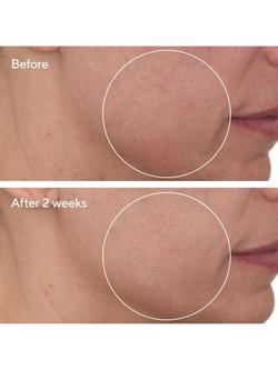 Murad Cellular Hydration Barrier Repair Cream, 50ml - view 2, 