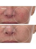Murad Cellular Hydration Barrier Repair Serum, 30ml