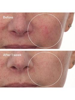 Murad Cellular Hydration Barrier Repair Serum, 30ml - view 2, 