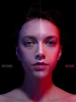 FOREO FAQ™ 101 Professional RF & LED Facial Rejuvenation, Multi - view 2, Na