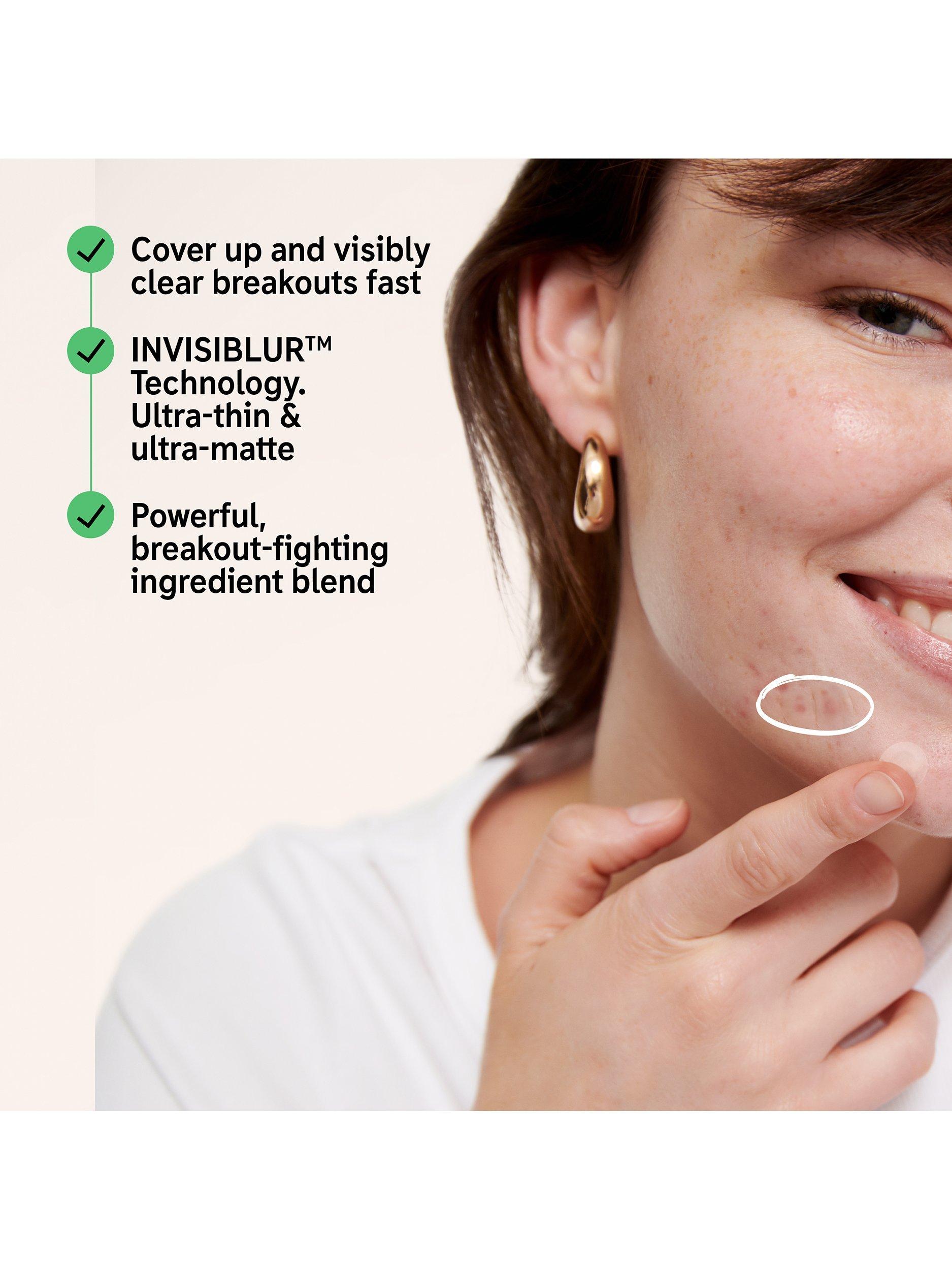 Product image 3 of 3, which shows The INKEY List Hydrocollid Invisible Pimple Patches