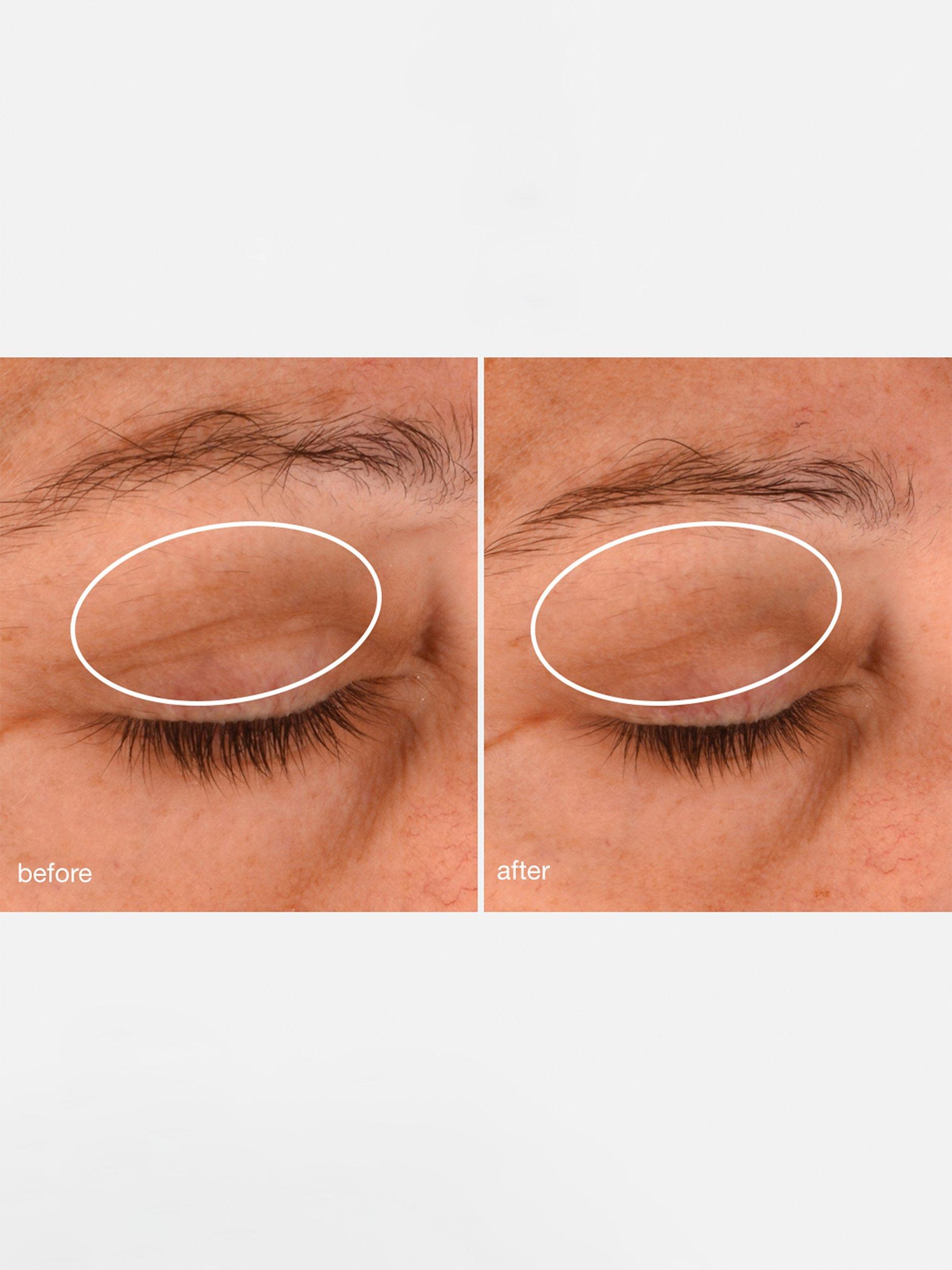 Product image 4 of 6, which shows Dermalogica Phyto Nature Lifting Eye Cream, 15ml