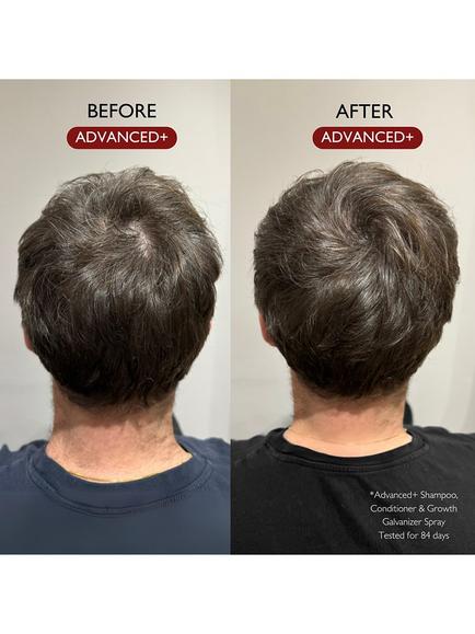 Daimon Barber Advanced+ Hair Growth Galvanizer Spray, 100ml - view 2, 