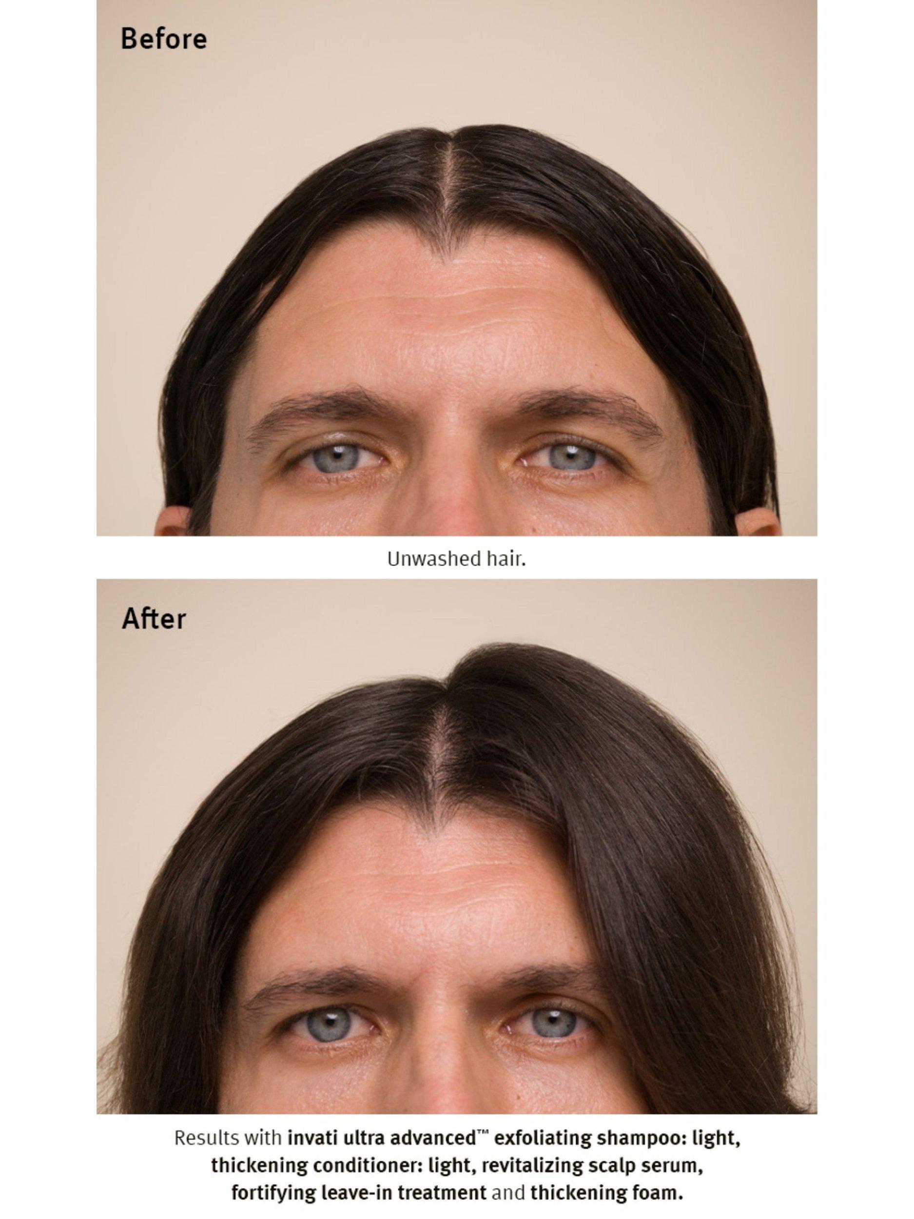 Product image 7 of 11, which shows Aveda Invati Ultra Advanced™ System Light Haircare Gift Set