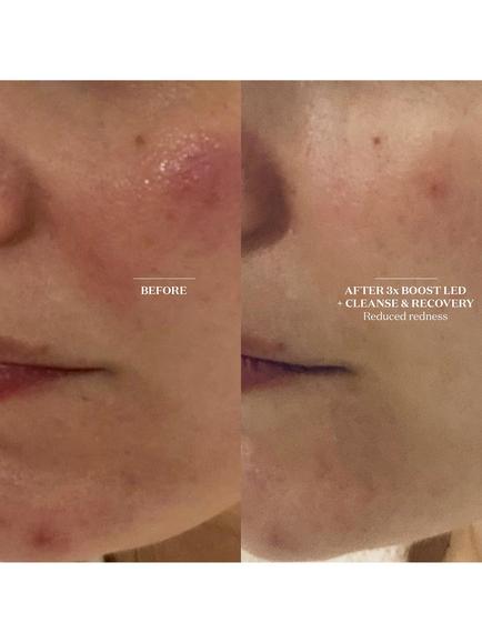 The Light Salon Cleanse & Recovery Spray, 100ml - view 2, 