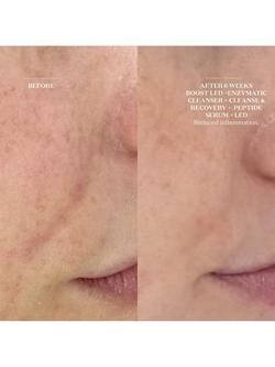 The Light Salon Enzymatic Cleanser & Mask, 150ml - view 2, 