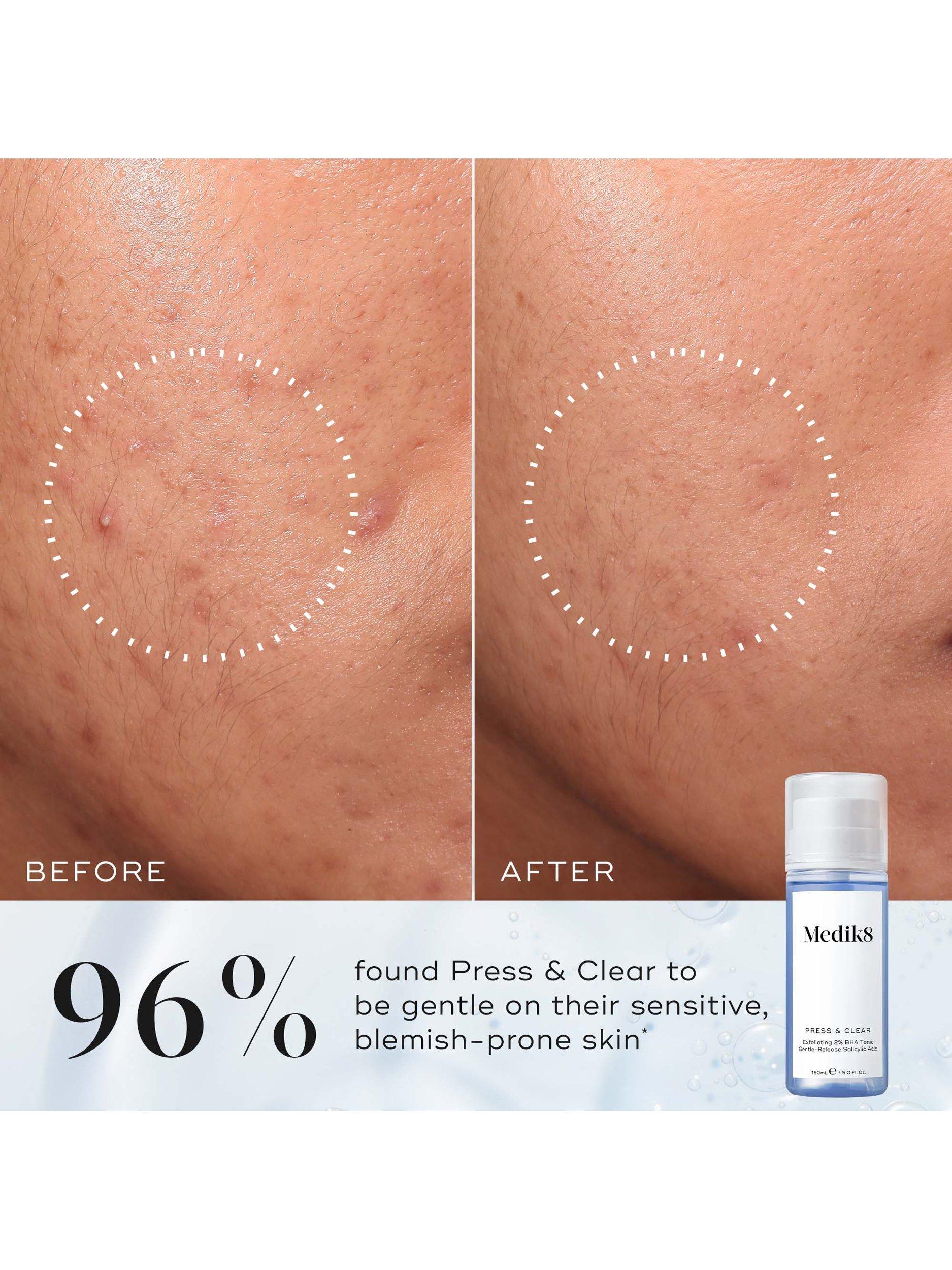 Product image 3 of 6, which shows Medik8 Press & Clear Refill, 150ml