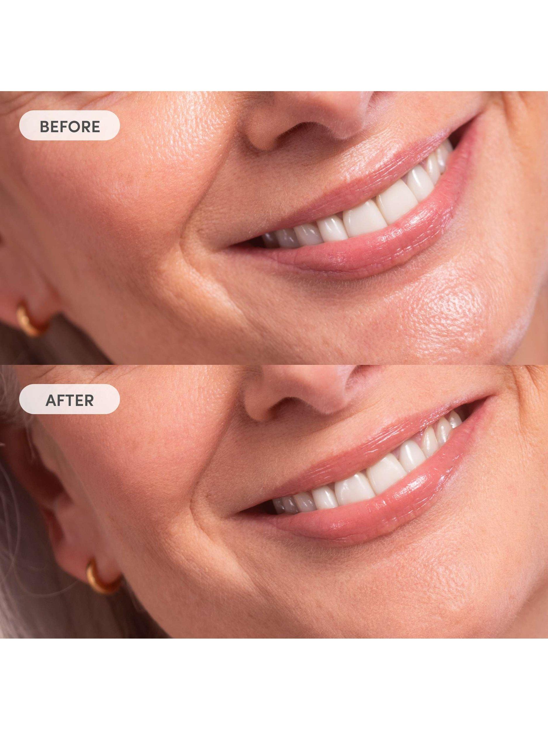 Product image 3 of 4, which shows Trinny London Miracle Blur Line Filler, 4g
