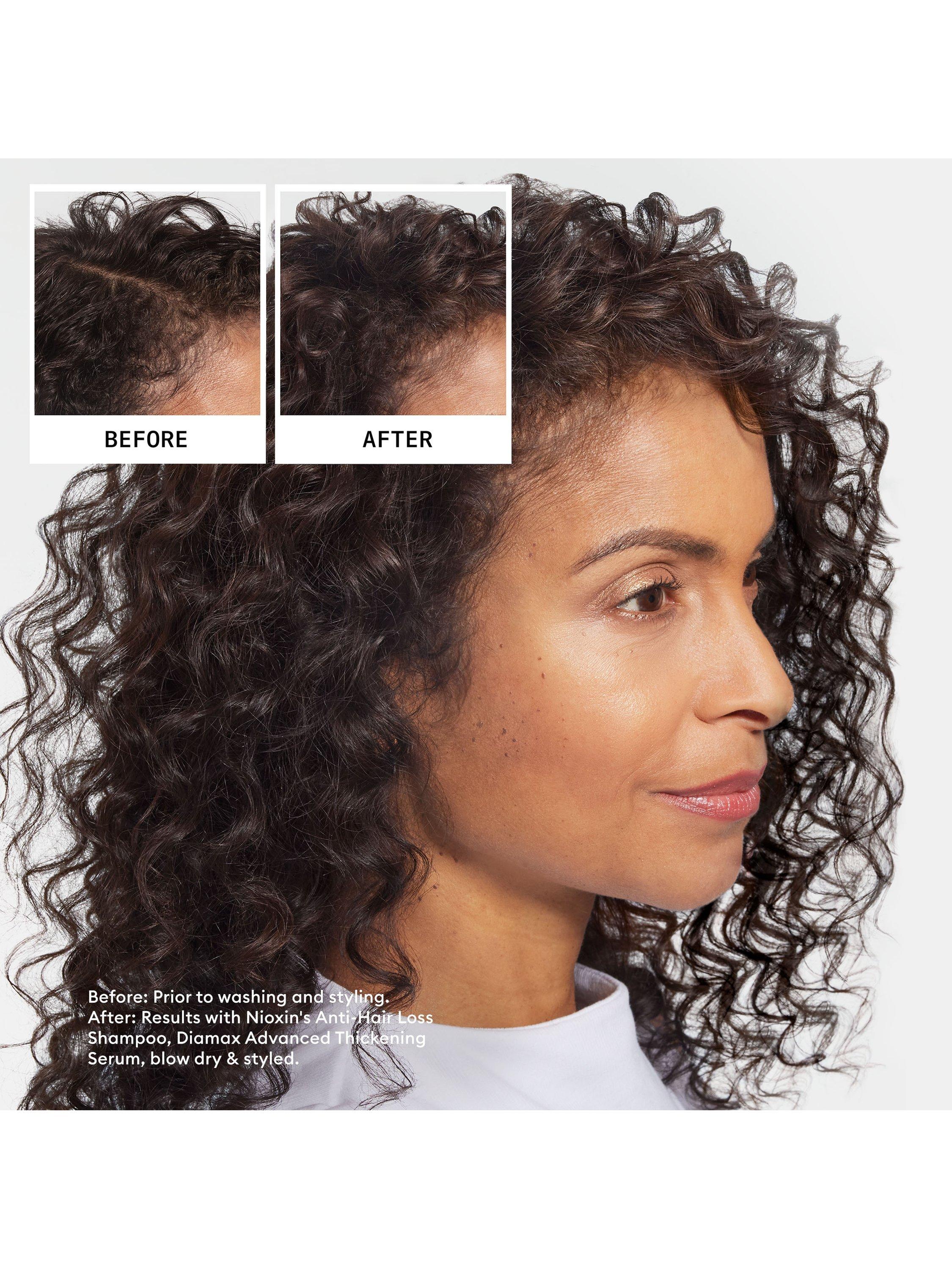 Product image 7 of 9, which shows Nioxin Pro Clinical Anti-Hair Loss Shampoo, 240ml