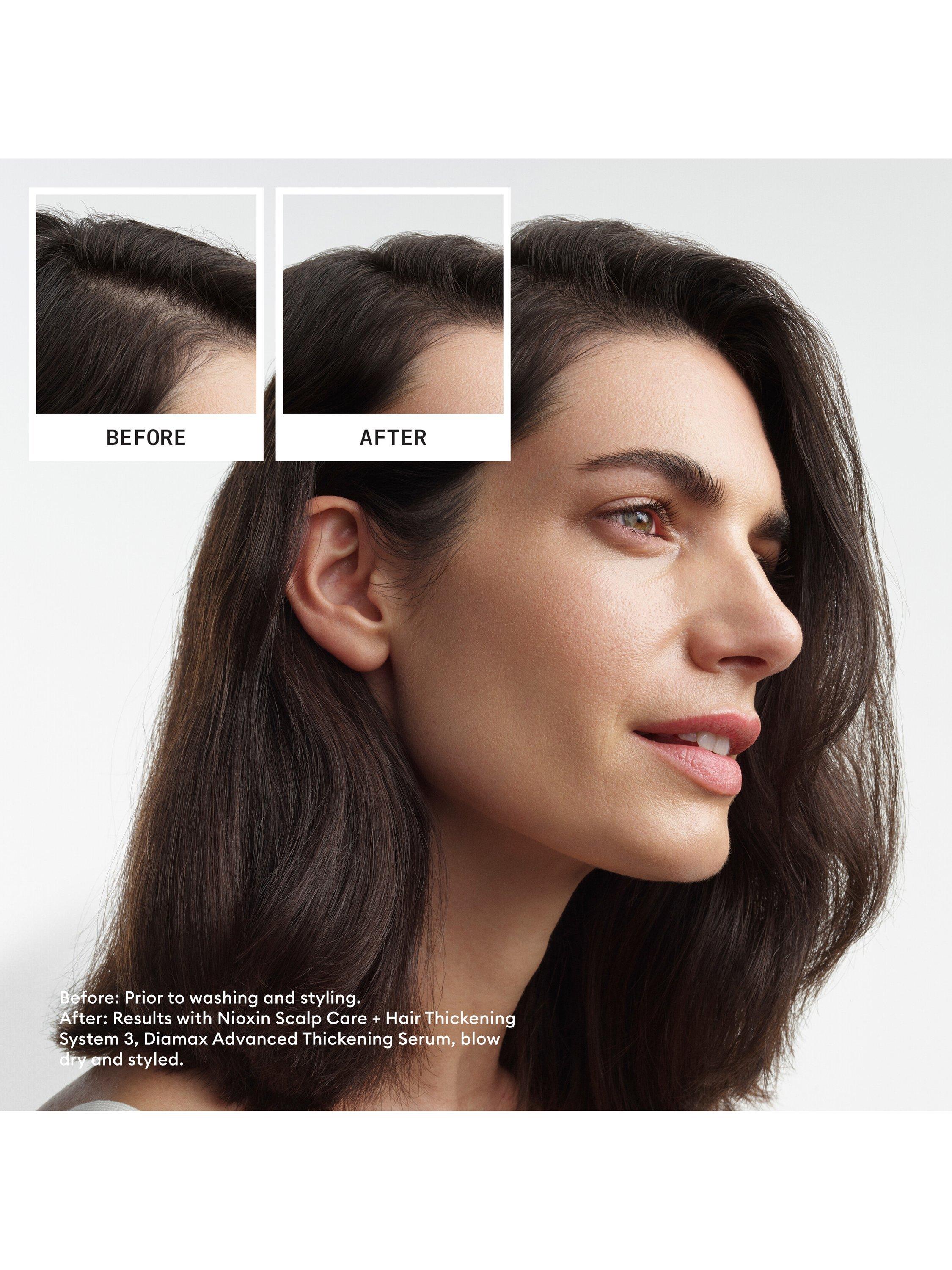 Product image 7 of 11, which shows Nioxin Pro Clinical Scalp + Hair Thickening System Kit 3 for Coloured Or Dry Damaged Hair with Light Thinning