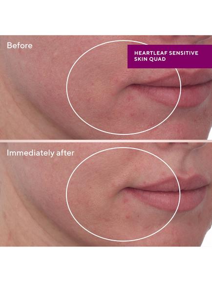 Murad Heartleaf Gentle Resurfacing Serum, 30ml - view 2, 