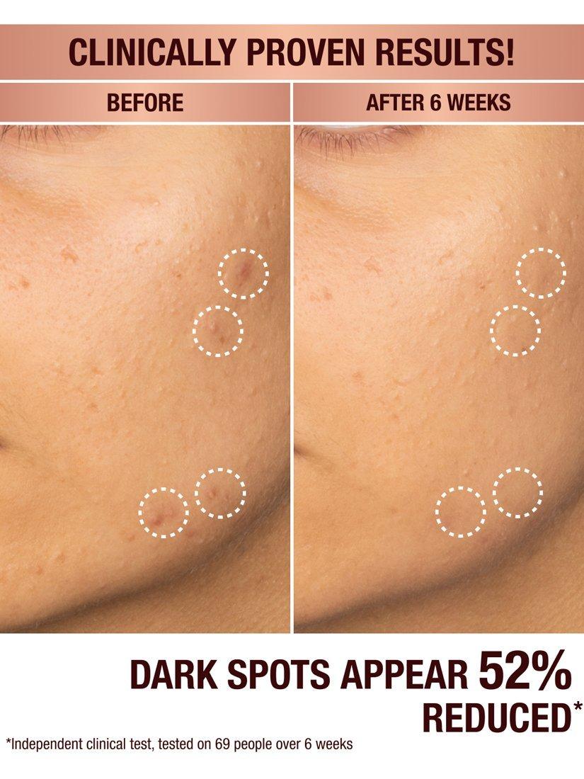 Product image 3 of 8, which shows Charlotte Tilbury Dark Spot Correcting Radiance Recovery Serum, 30ml