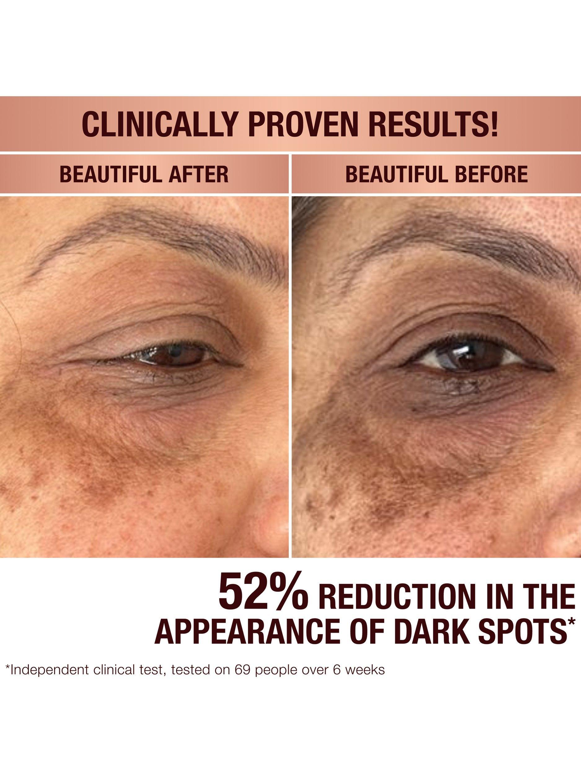 Product image 4 of 8, which shows Charlotte Tilbury Dark Spot Correcting Radiance Recovery Serum, 30ml