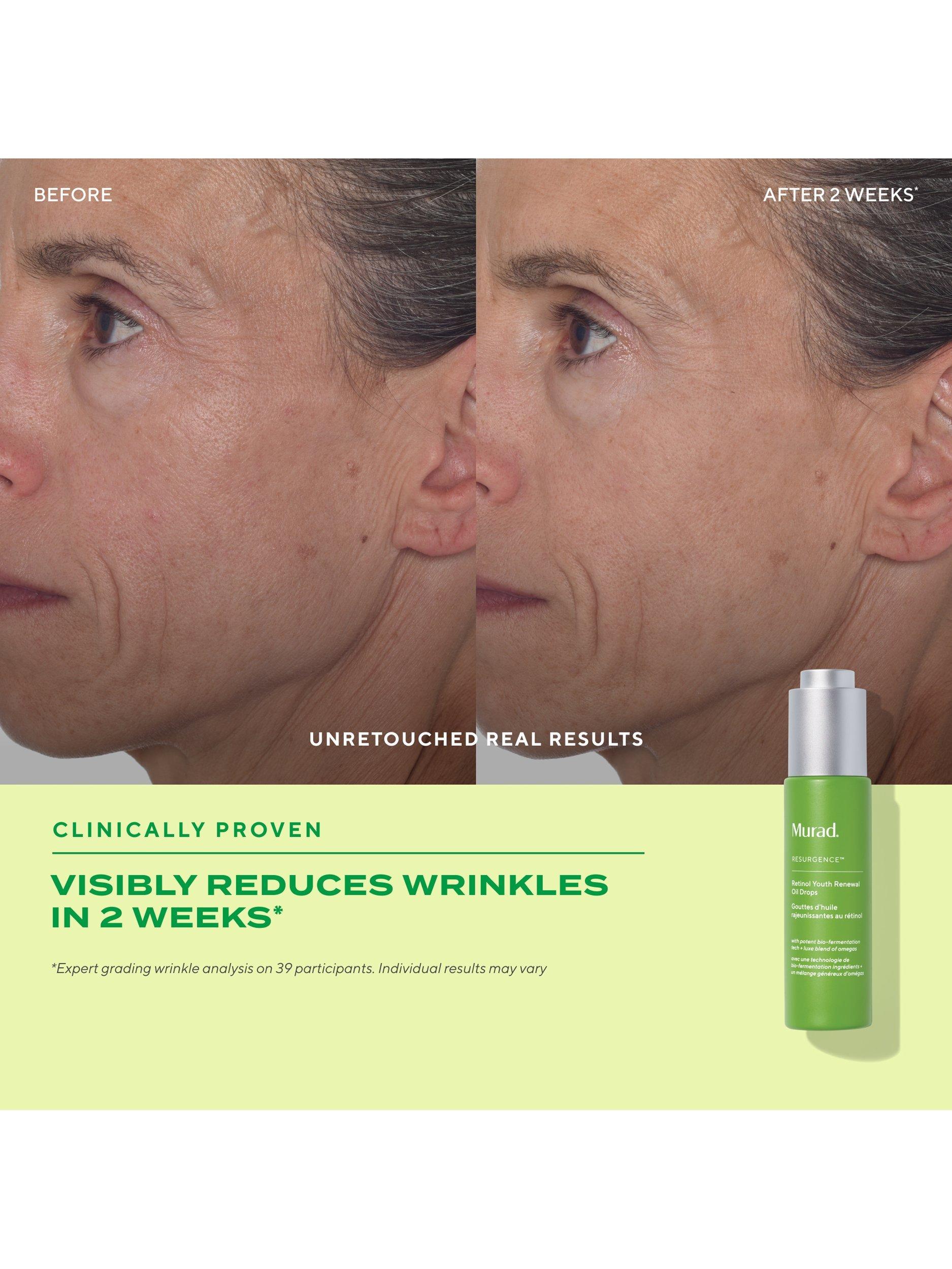 Product image 4 of 9, which shows Murad Retinol Youth Renewal Oil Drops, 30ml