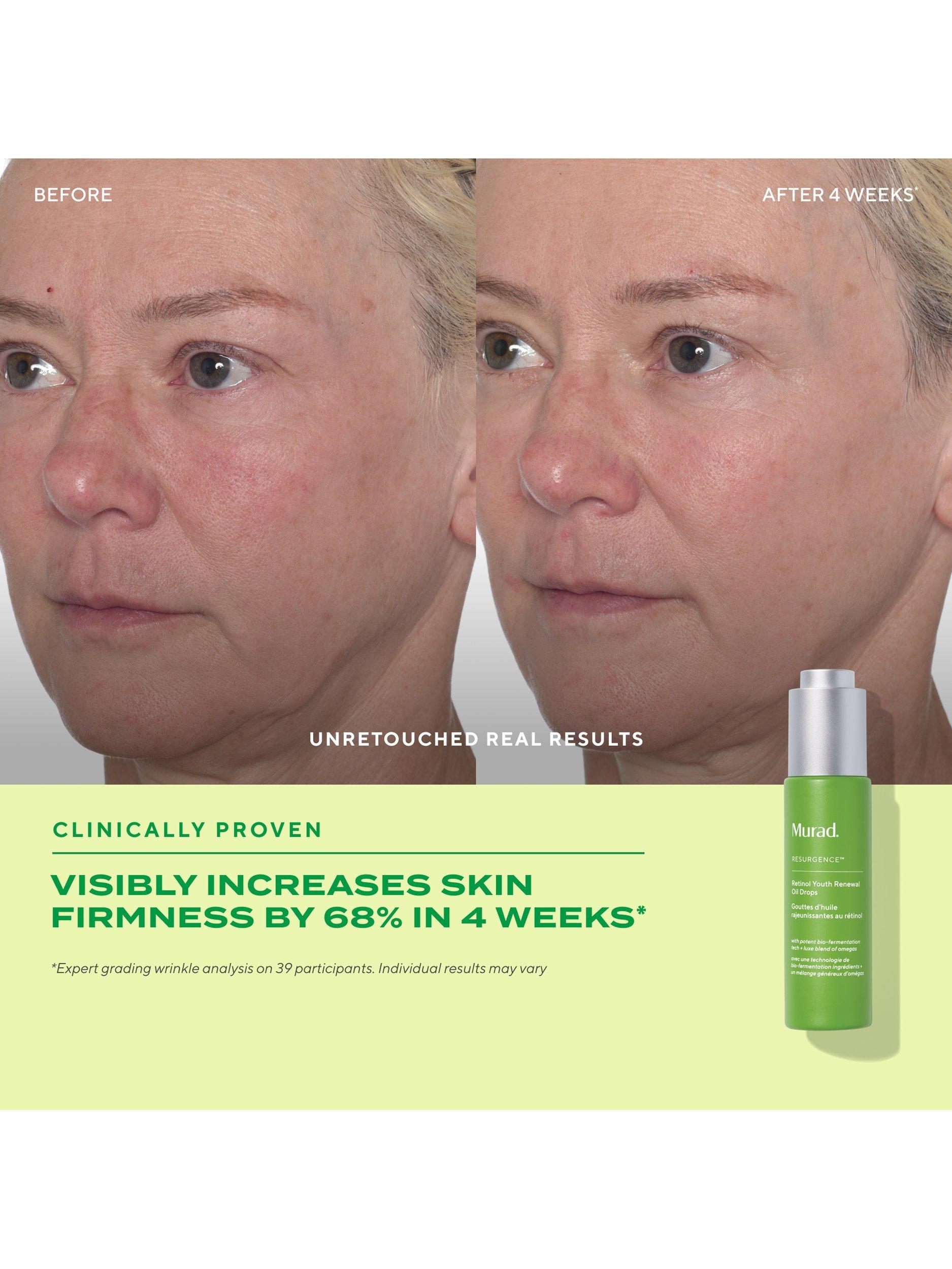 Product image 5 of 9, which shows Murad Retinol Youth Renewal Oil Drops, 30ml