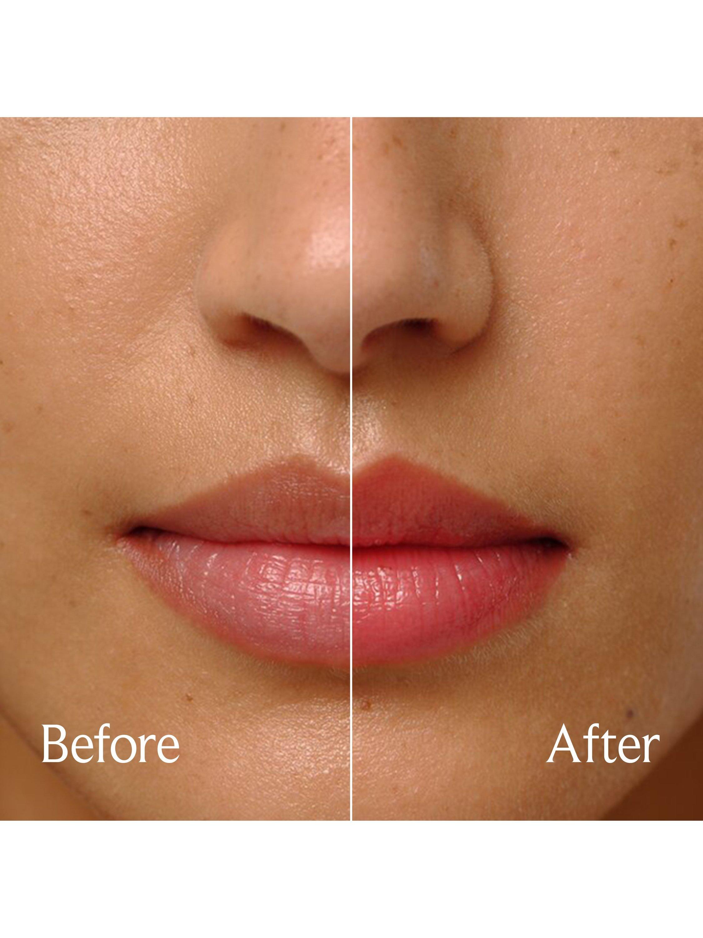 Product image 5 of 7, which shows Fresh Sugar Treat Lip Oil, Rose