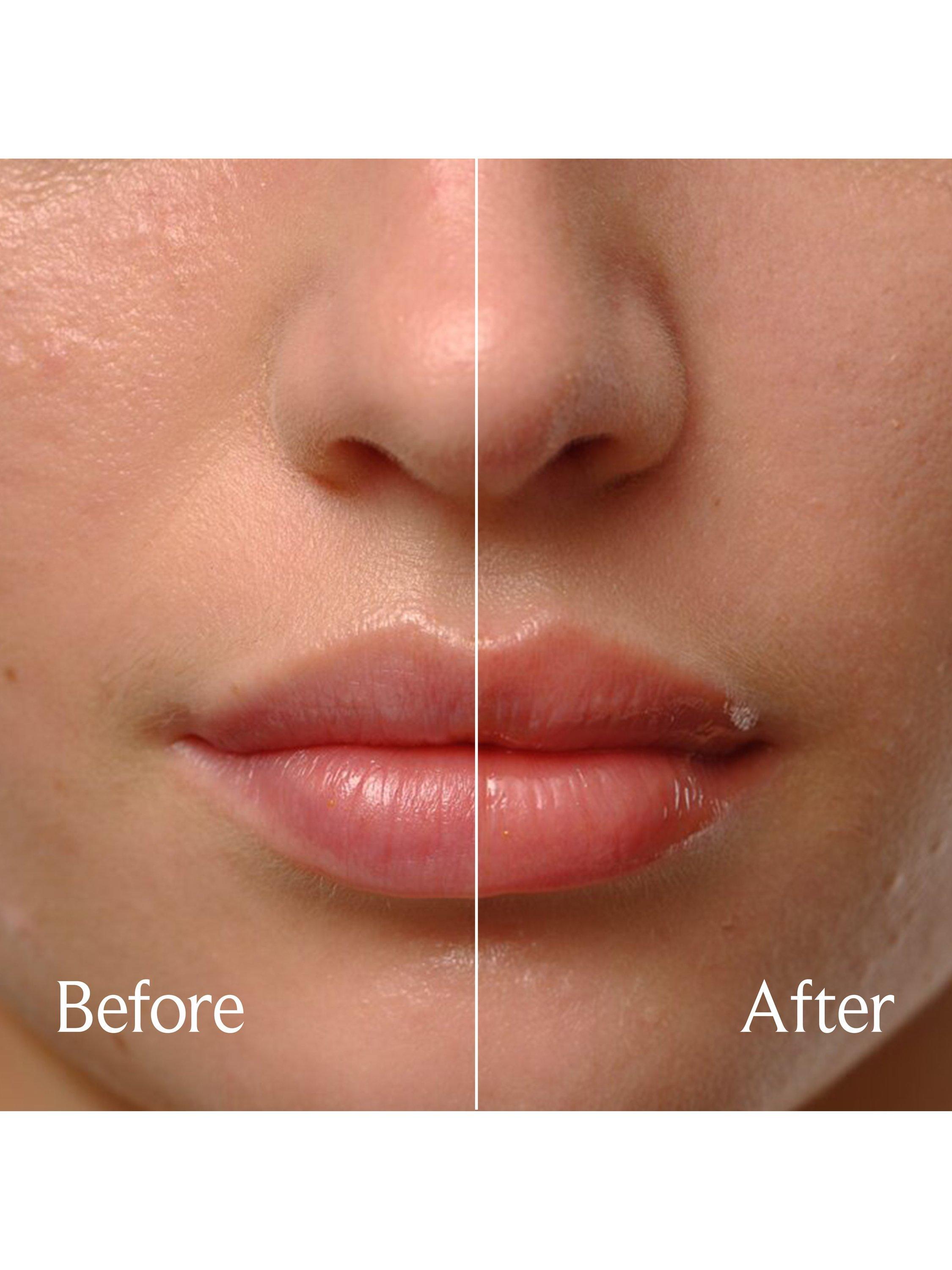 Product image 5 of 7, which shows Fresh Sugar Treat Lip Oil, Honey