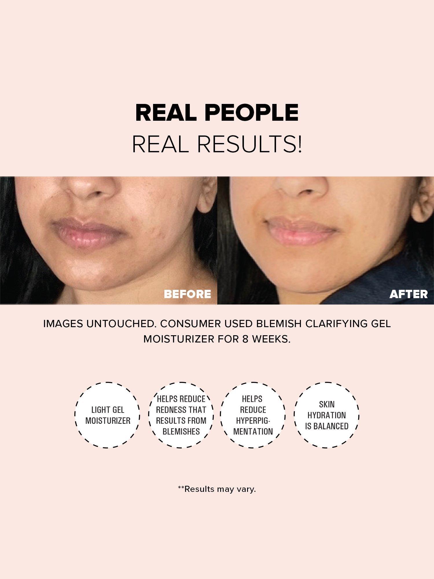 Product image 5 of 11, which shows Nudestix 2% Salicylic Acid Blemish Clarifying Gel Moisturiser, 60ml