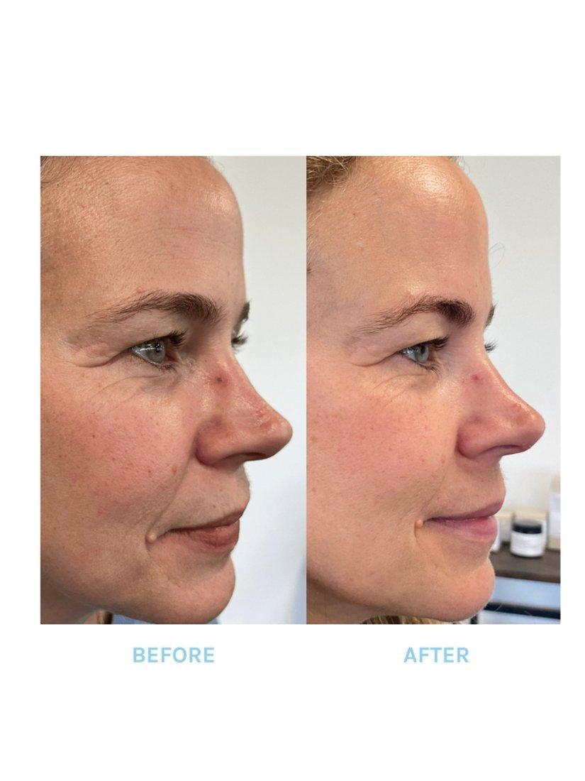 Product image 5 of 5, which shows Evolve Organic Beauty Age Defying Lifting Serum, 30ml