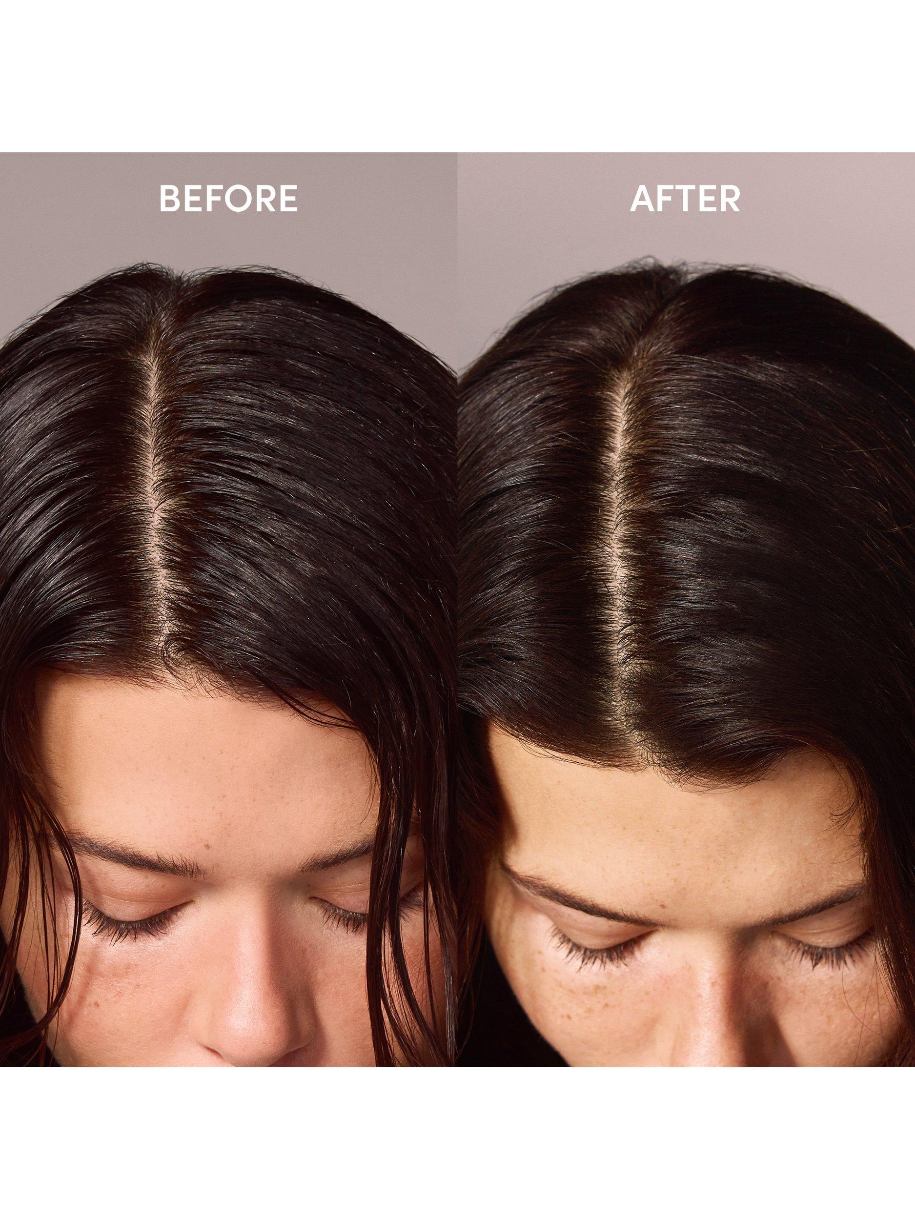 Product image 3 of 9, which shows OUAI Super Dry Shampoo, 127g