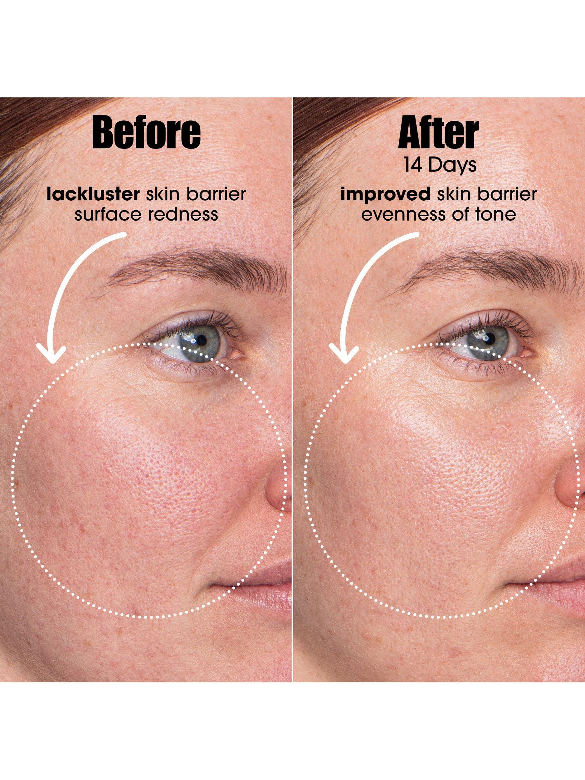 Product image 3 of 7, which shows Sunday Riley A.I. Smart Retinoid Serum, 30ml