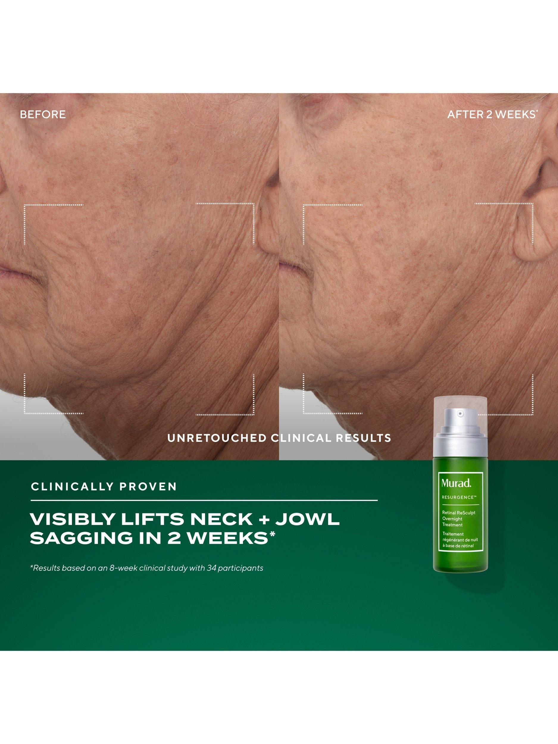 Product image 5 of 8, which shows Murad The Retinal Resculptors Skincare Gift Set