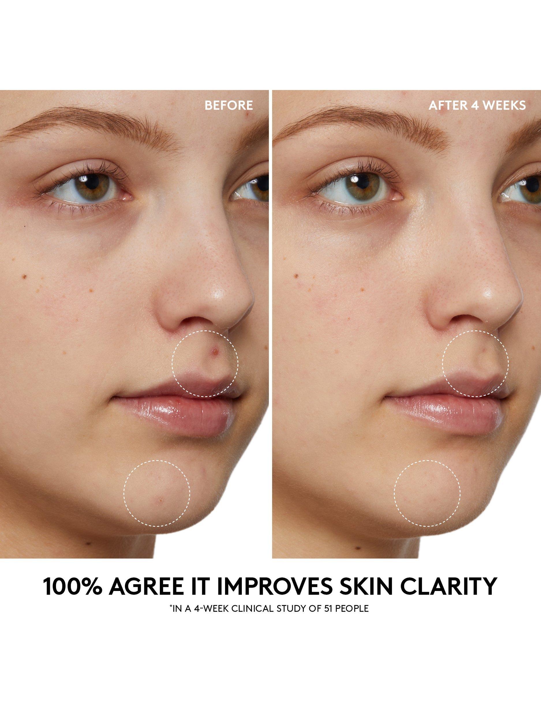 Product image 4 of 8, which shows Fenty Skin Cherry Dub Pore Purify'r Gel Cleanser, 190ml