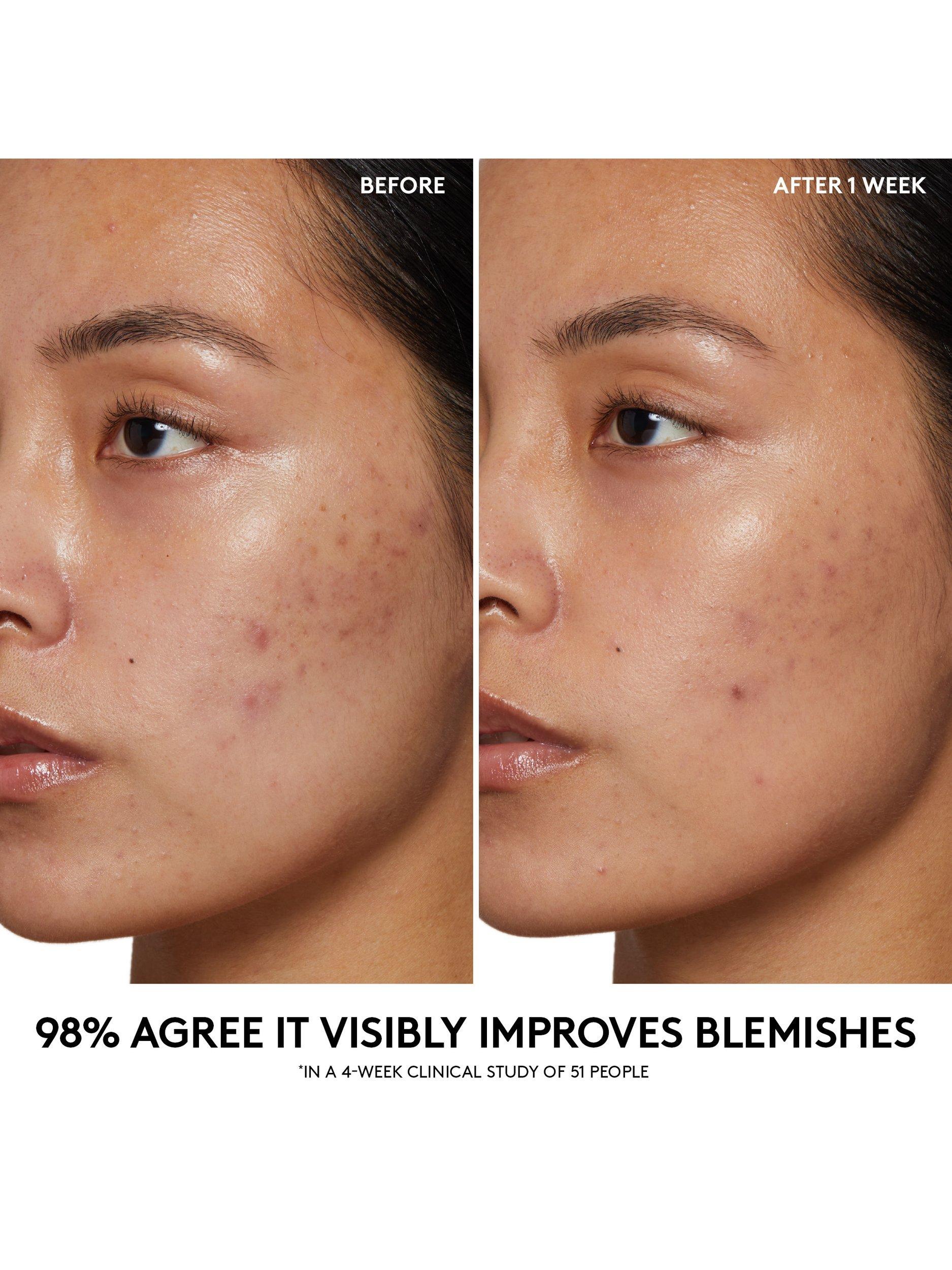 Product image 5 of 8, which shows Fenty Skin Cherry Dub Pore Purify'r Gel Cleanser, 190ml